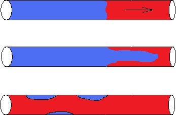 виды тромбоза